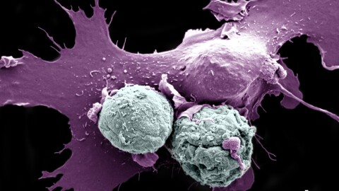 A large dendritic cell beginning to, as Rita Serda said, "internalize/eat/phagocytose" two zombie vaccine cells (image from a scanning electron microscope with false-color added for clarity)