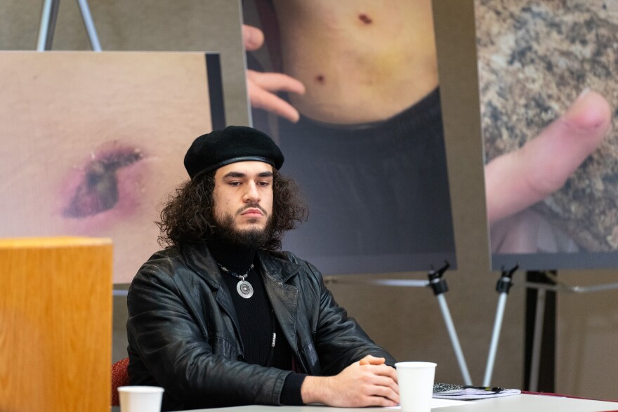 Behind Gamboa stood 3 photos on easels that showed, he said, his bullet wounds from Matt Alder shooting at him, Dec. 9, 2025.