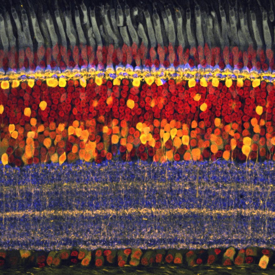 This image of a chick's retina reveals the three basic stages of processing by the circuit that captures light and translates it into signals the brain can understand.