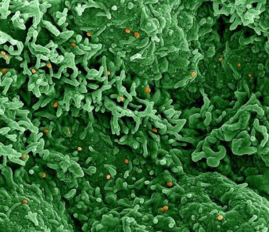  Colorized scanning electron micrograph of monkeypox virus (orange) on the surface of infected VERO E6 cells (green).