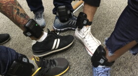 Several people wearing electronic monitors