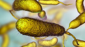 Bacterium Vibrio vulnificus, the causative agent of serious seafood-related  and infected wound infections.