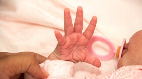 The U.S. infant mortality rate dropped slightly in 2024, after rising the year before, according to the Centers for Disease Control and Prevention.