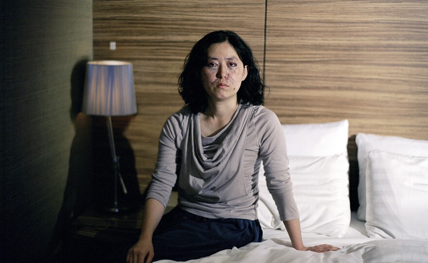 Photographer Ji Yeo took portraits of women in South Korea recovering from plastic surgeries.