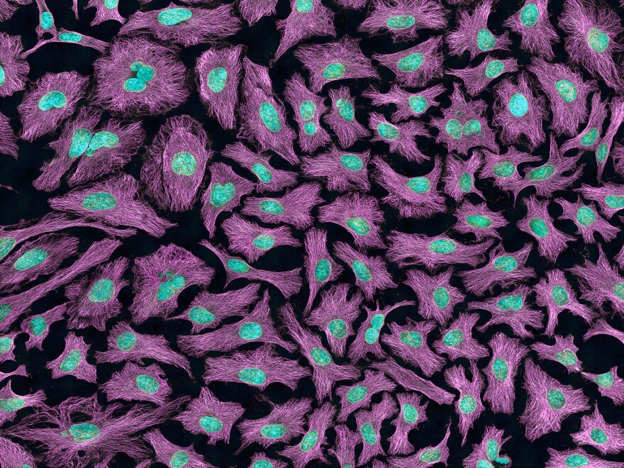 HeLa cells, commonly used in research, were derived from cervical cancer cells taken in 1951 from Henrietta Lacks without her permission.