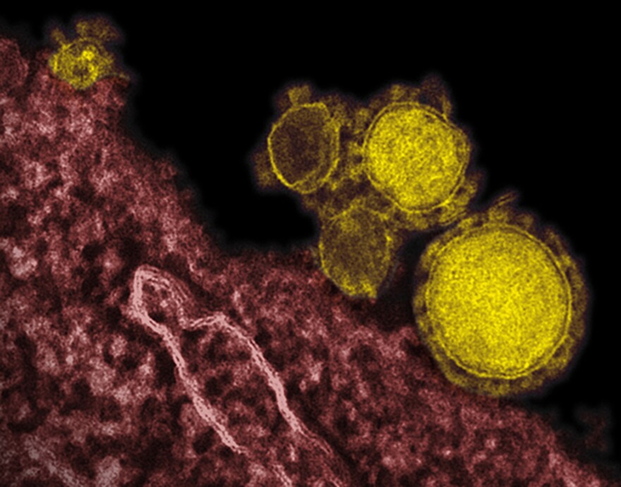 This undated file electron microscope image made available by the National Institute of Allergy and Infectious Diseases - Rocky Mountain Laboratories shows novel coronavirus particles, also known as the MERS virus, colorized in yellow.