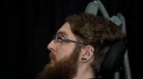 Neuro interface patient Nathan Copeland, a quadriplegic brain implant patient who can experience the sensation of touch and control a remote robotic arm with his brain, listens as US President Barack Obama speaks while touring innovation projects at the White House Frontiers Conference.