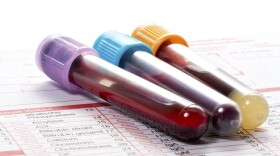 Three medical vials filled with blood for analysis