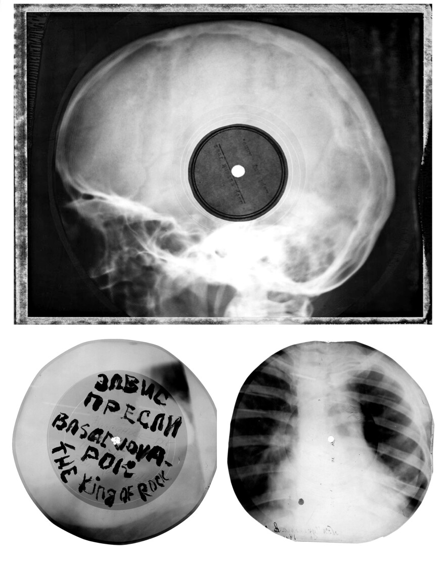 During the 1950s, with vinyl scarce, Russians began recording rock 'n' roll, jazz and boogie woogie on used X-rays that they gathered from hospitals and doctors' offices. They would cut a crude circle out with manicure scissors and use a cigarette to burn a hole.