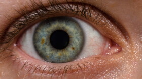 Human eye