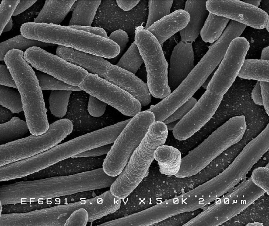 This is a photo of E. coli bacteria.