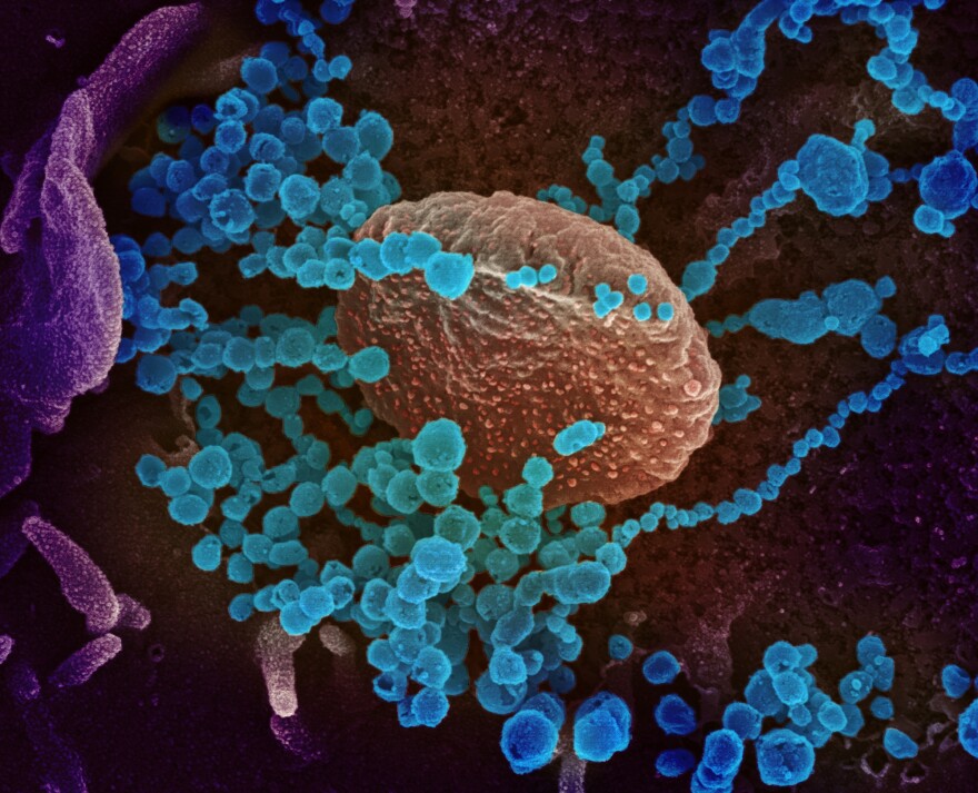A microscopic image shows a big orange circle with small blue circles around it.