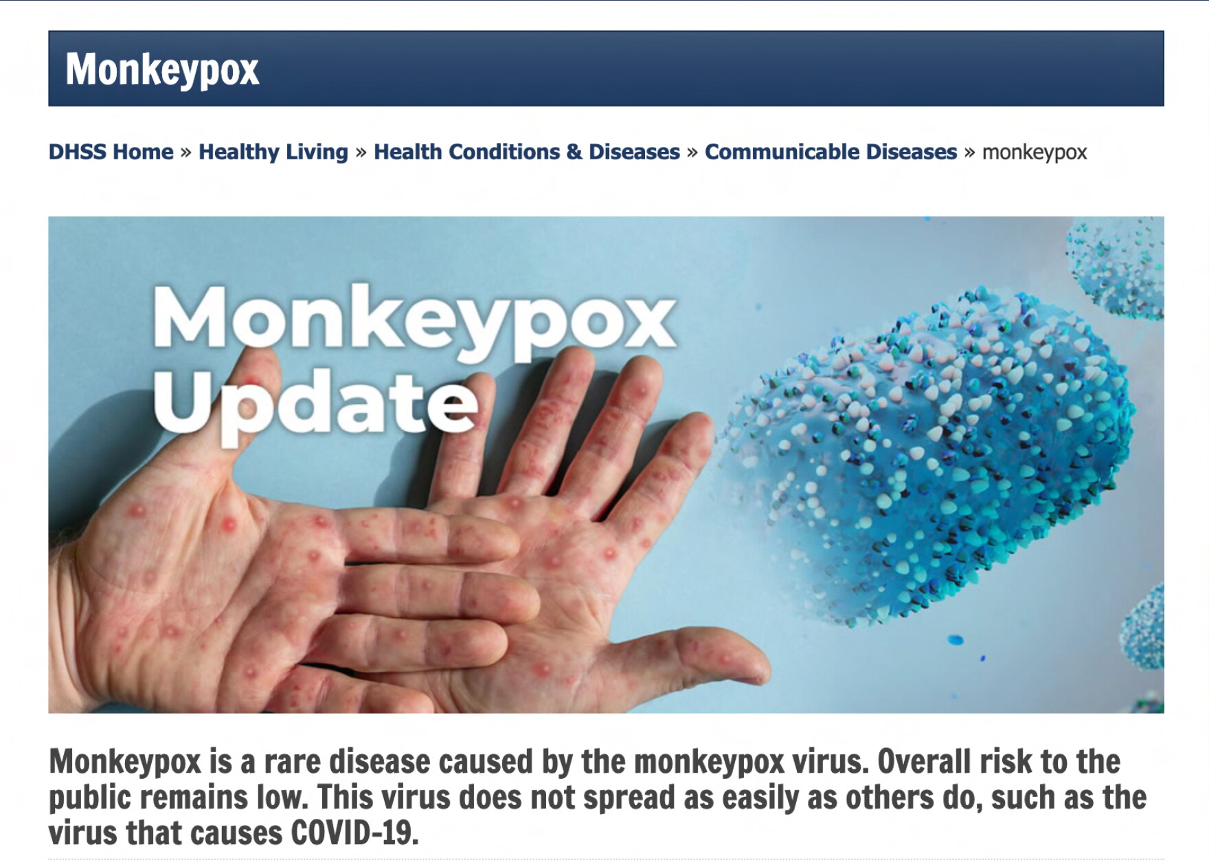 Boone County confirms first monkeypox case as Missouri plans for more ...