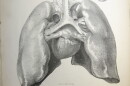 Specialized cells inside the heart can't switch jobs to start dividing if they're injured.