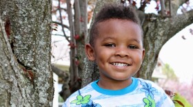 Elijah Peacock, 5, lives with acute flaccid myelitis.