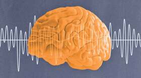 By stimulating a part of the brain linked to addiction, UVA scientists hope to eliminate cravings in cocaine addicts.