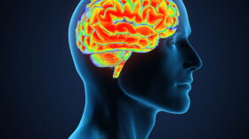 Profile view of man and his brain.  In our second hour, guests explain the rehabilitation process and the road to recovery from brain injury.