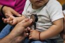A doctor's hand examines a 16-month-old boy 