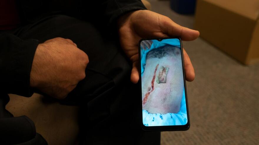 Ahmad Naem Wakili shows an image of his injuries following a shooting attack in Kabul that happened just weeks before he was evacuated from Afghanistan.