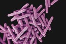 A 3-D, computer-generated image of drug-resistant, Mycobacterium tuberculosis bacteria, the pathogen responsible for causing the tuberculosis disease.