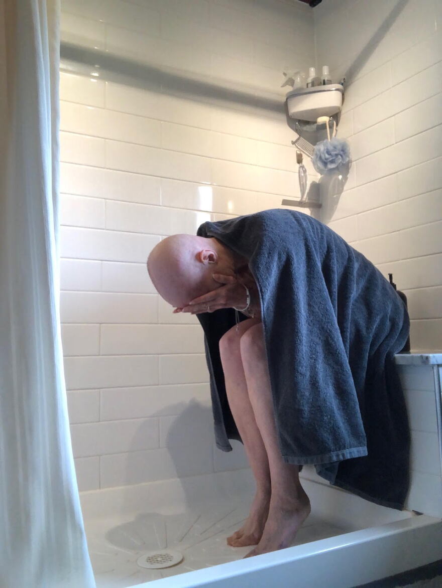 A bald woman sits in a shower, leaning over, and holds her face in her hands.