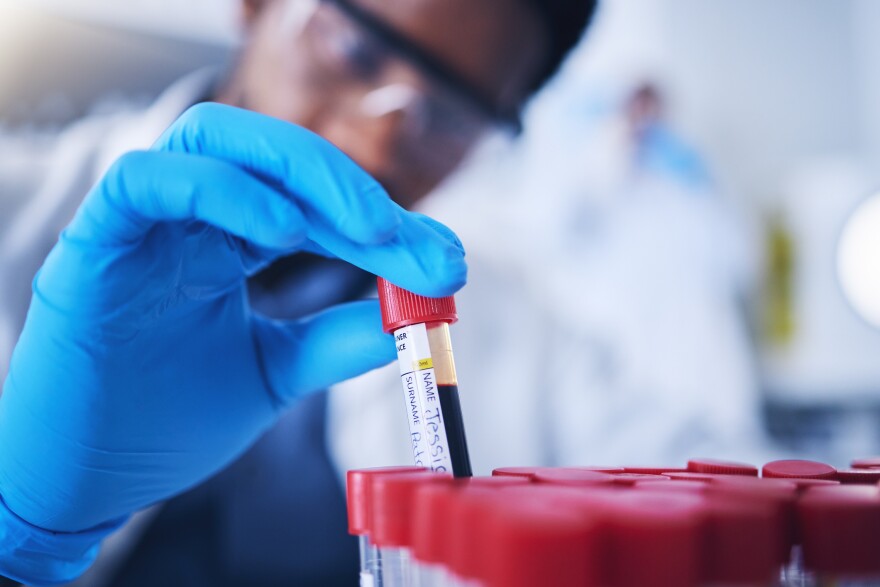 A lab worker holds a vial of blood 