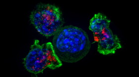 A group of killer T cells (green and red) surrounding a cancer cell (blue, center). (National Institutes of Health/Flickr)