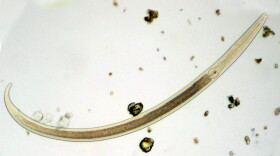 Vinegar eels are actually small creatures known as nematodes, like this one shown above.
