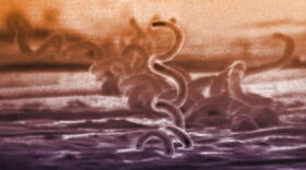 The cause of syphilis is a bacterium called Treponema pallidum.