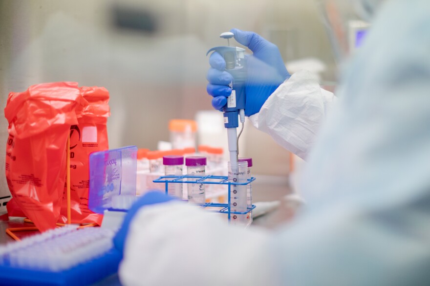 The Pennsylvania Department of Health said last week it started adding the reinfection case numbers first in Philadelphia then for the other 66 counties.