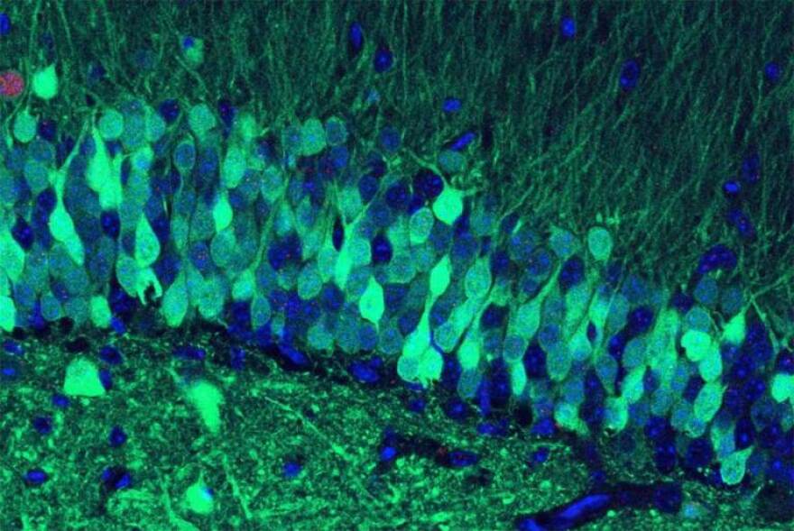 These cells in the hippocampus of our brains help in the transition between short-term and long-term memory