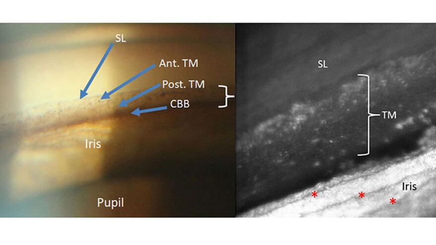 The left image shows what can usually be seen in a doctor's office. The right image shows a portion of the same part of the eye in much greater detail using methods developed at IU.