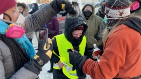 A woman receives help after getting hit in the face by chemical irritants from federal law enforcement officers in Minneapolis, Minnesota, on Saturday, January 24, 2026. Citizens in the city have been protesting the presence of federal immigration officers since they arrived in late December.