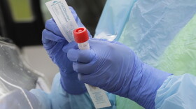 A nurse holds a vial and a swab at a drive-up coronavirus testing station at a hospital in Seattle. (Ted S. Warren/AP)