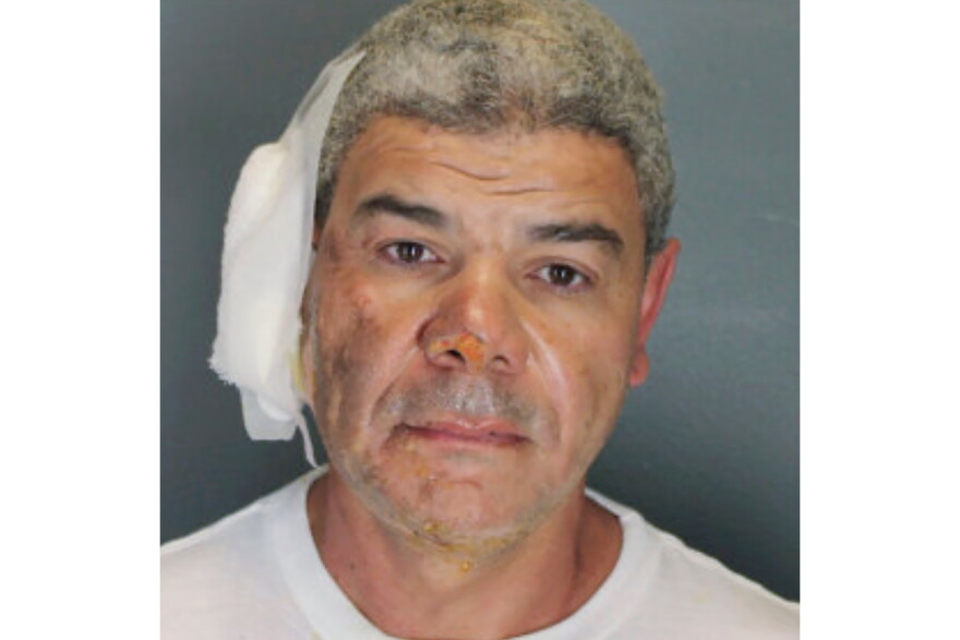 Mohamed Sabry Soliman's mugshot. He wears a large bandage on the right side of his head.
