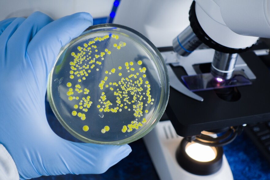An overhead, close-up shot shows a gloved hand holding a round glass petri dish filled with clear agar and numerous distinct, circular yellow bacterial colonies. In the background, a modern white and black microscope features a glowing light source and a slide positioned on the stage, set against a dark blue surface.