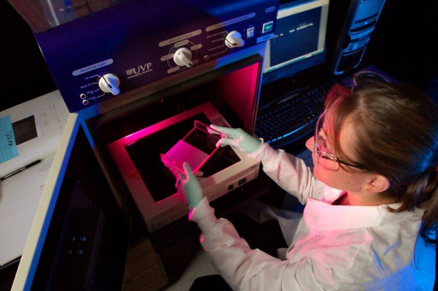 High angle photograph of Amanda McNulty, a NCHHSTP staff member, in a laboratory setting, holding an electrophoresis plate for DNA separation over the UVP imaging System, in an effort to examine HIV resistance to antiretroviral drugs, in people from PEPFAR (President's Emergency Plan for AIDS Relief) countries, 2007. Image courtesy CDC/Hsi Liu. (Photo by Smith Collection/Gado/Getty Images)