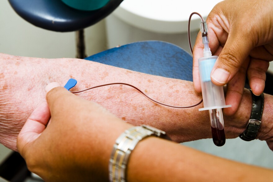 Scientists have long searched for a way to detect Alzheimer's disease before symptoms appear.