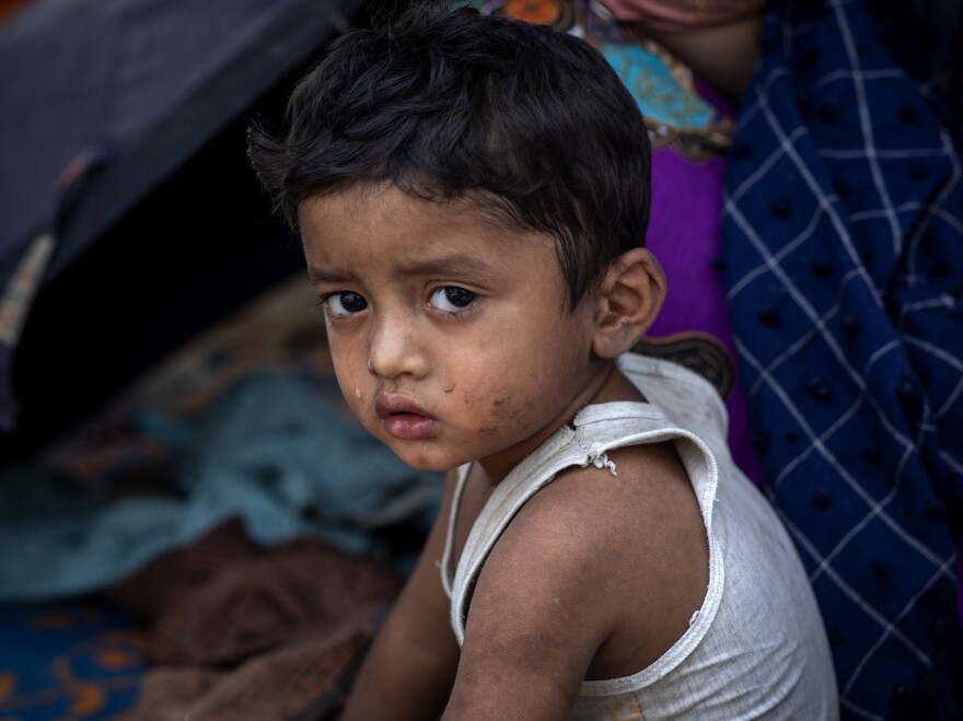 A Rohingya refugee boy shown after a massive fire broke out in March, destroying thousands of shelters and killing at least 15 people at Balukhali refugee camp in Cox's Bazar, Bangladesh.