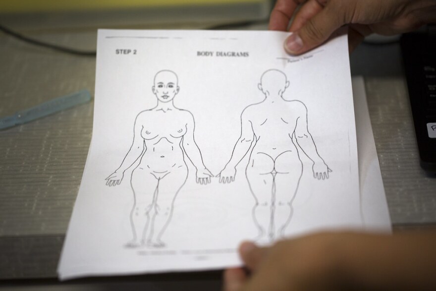 A diagram used to mark injuries during a sexual assault exam 