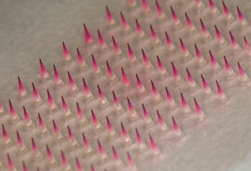 The microneedles attached to this patch dissolve after being pressed into skin, releasing a dose of vaccine. Each microneedle is less than a millimeter in length.