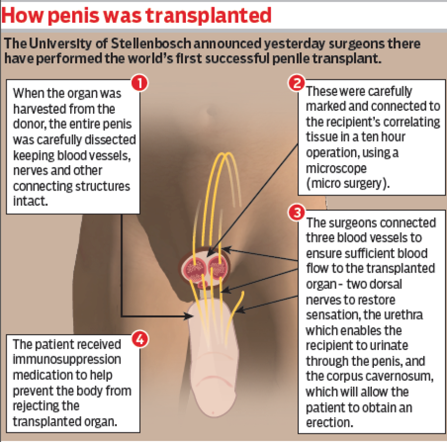 The first successful penile transplant.