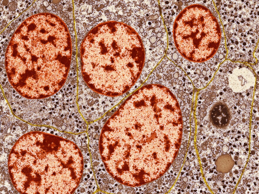 Patients with Type-1 diabetes don't have enough healthy islets of Langerhans cells — hormone-secreting cells of the pancreas. Granules (orange in this image) inside these cells release insulin and other substances into the blood.