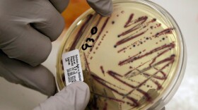 FILE - A microbiologist points out an isolated E. coli growth on an agar plate at the Washington State Department of Health, Nov. 3, 2015, in Shoreline, Wash. (AP Photo/Elaine Thompson, File)