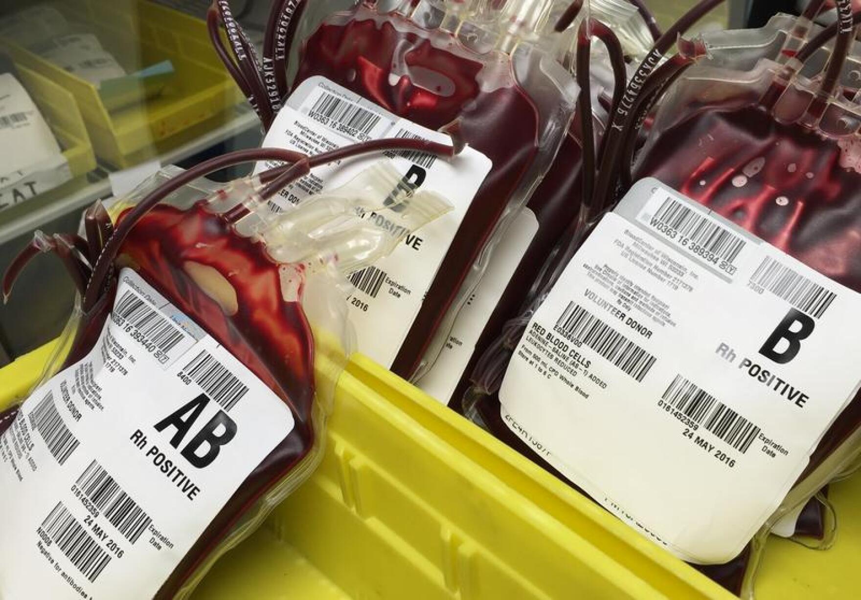 Blood Center of Wisconsin in Need of O Negative WUWM 89.7 FM