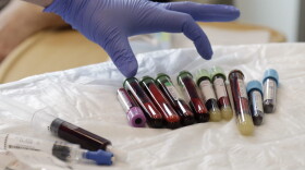 A nurse reaches for blood samples taken from a patient receiving immunotherapy. (Elaine Thompson/AP)
