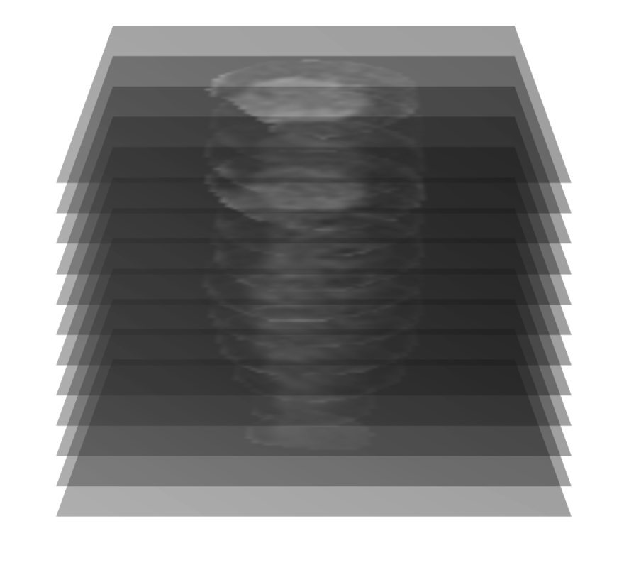 MRI imaging data of a human heart. Photo: JHU