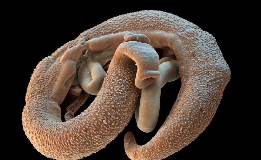 A male and female pair of <em>Schistosoma</em> parasites.