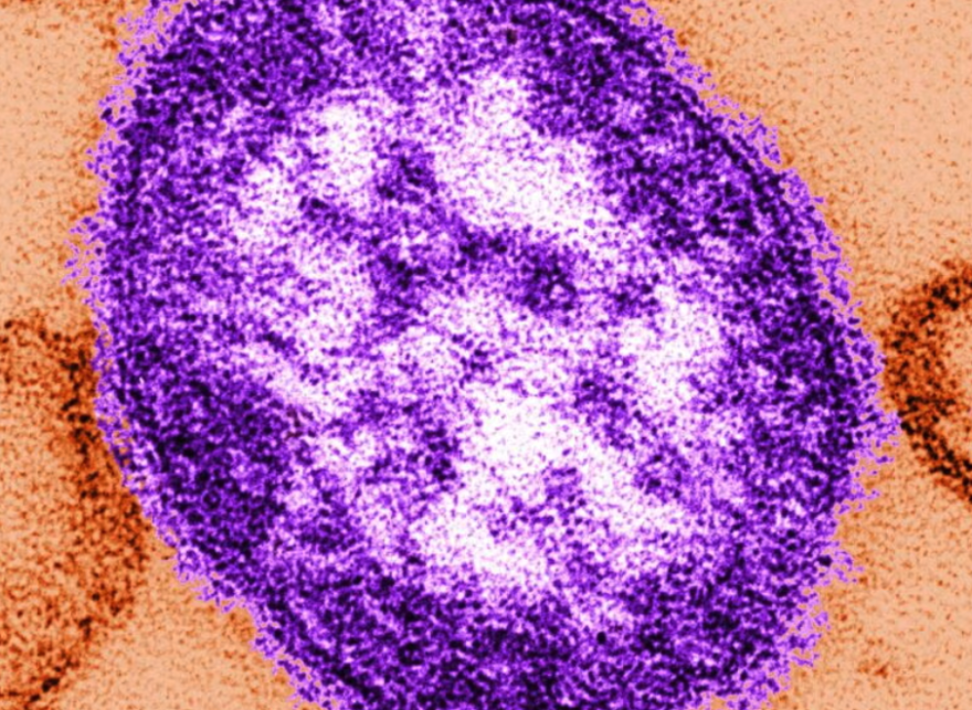 This undated image made available by the Centers for Disease Control and Prevention on Feb. 4, 2015 shows an electron microscope image of a measles virus particle, center. 