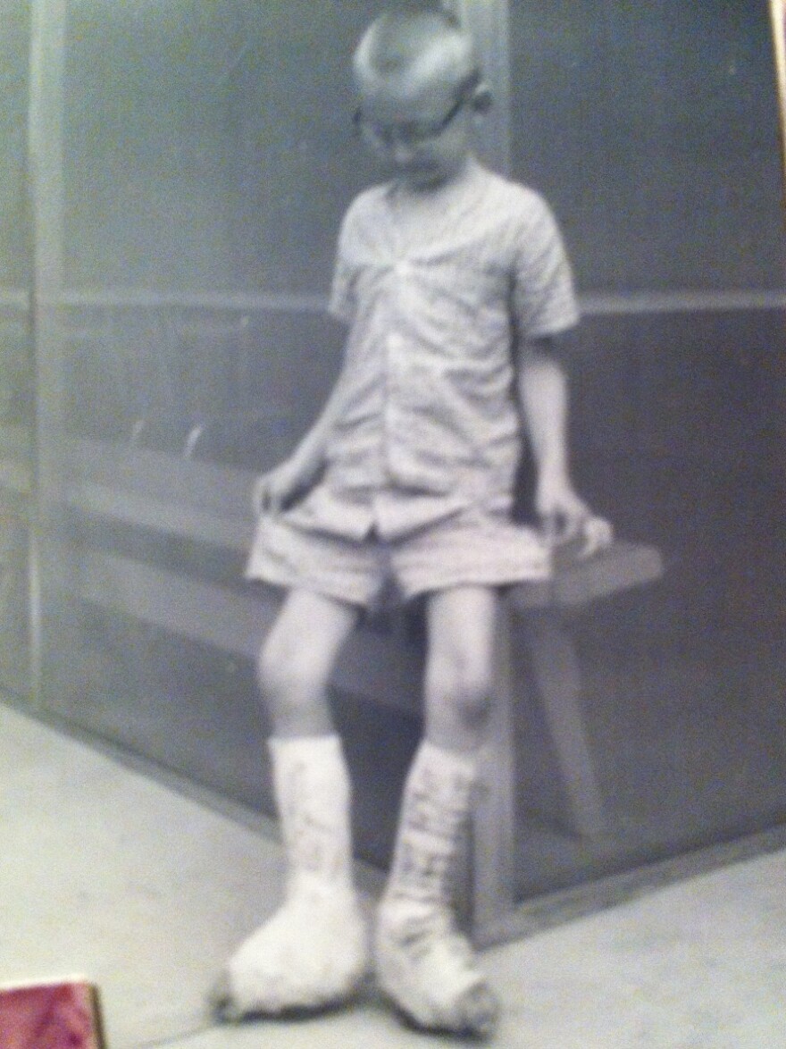 Doctors put casts on Curtis during summer months when he was a child, to immobilize his ankles and prevent injuries.